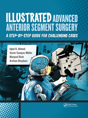 cover image of Illustrated Advanced Anterior Segment Surgery